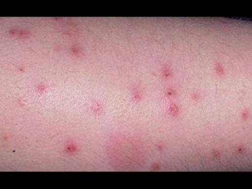 Прозрачные насекомые в квартире. Белые насекомые в квартире – кто это? 01 Прозрачные насекомые в квартире. Белые насекомые в квартире – кто это? 01